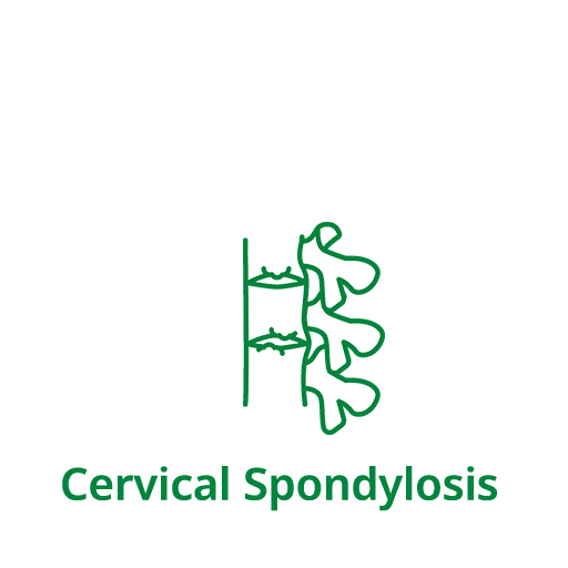 Cervical Spondylosis