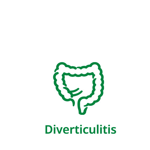 Diverticulitis