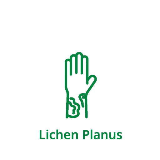 Lichen Planus