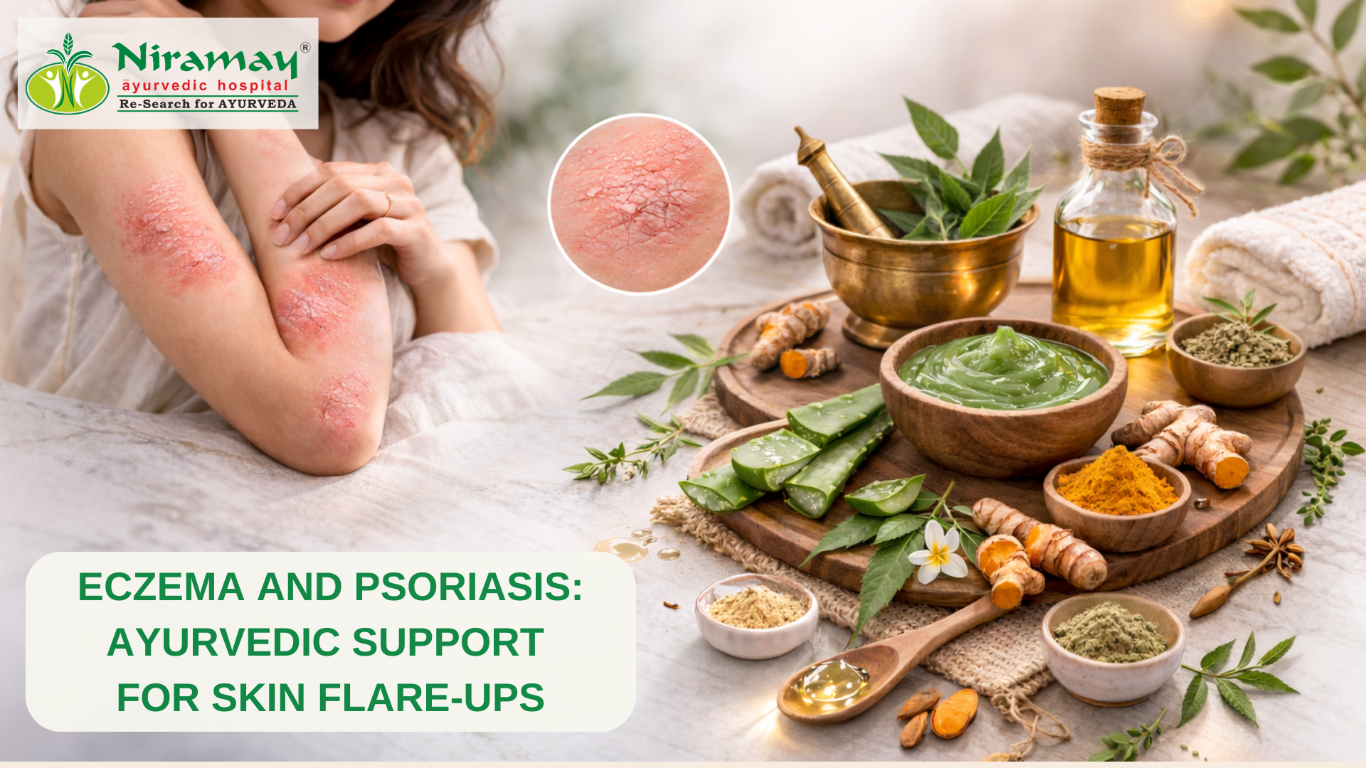 Read more about the article Eczema and Psoriasis: Ayurvedic Support for Skin Flare-Ups