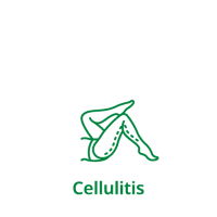 Cellulitis